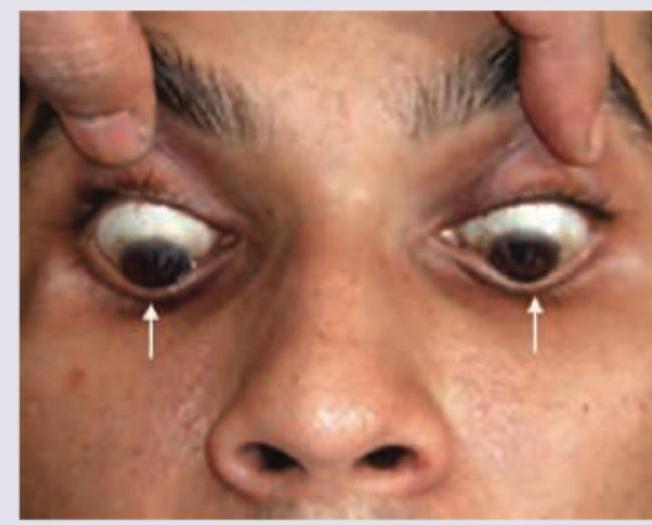 Image for question 327