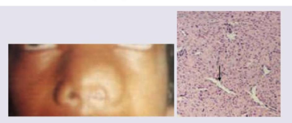 Image for question 335