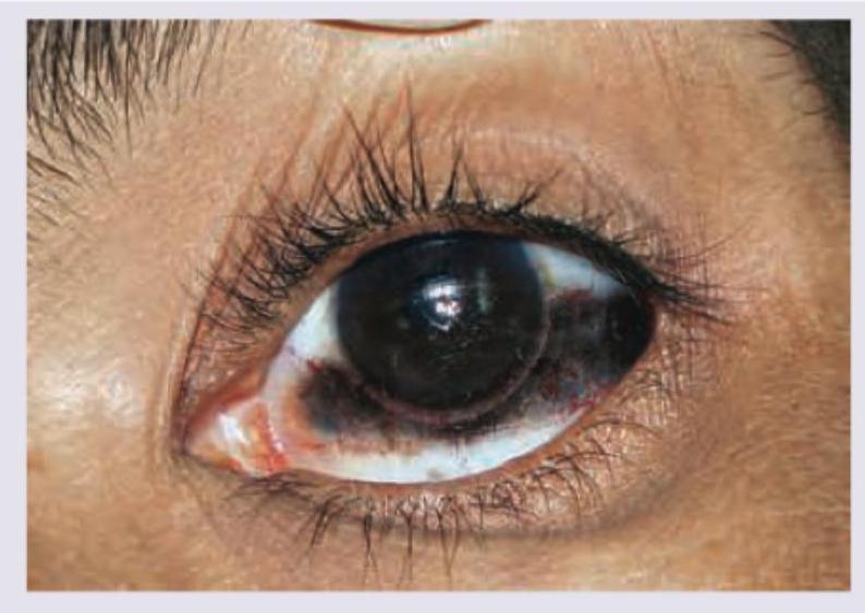 Image for question 310