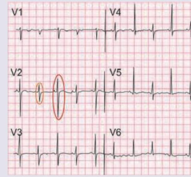 Image for question 16