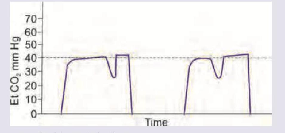 Image for question 292
