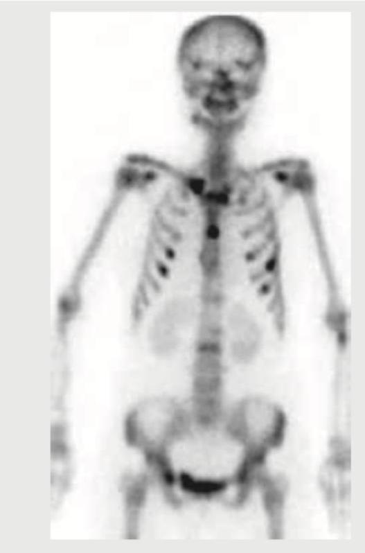 Image for question 163