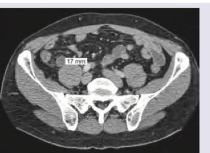 Image for question 540