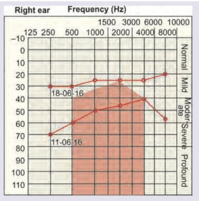 Image for question 48