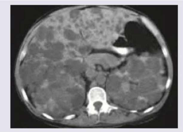 Image for question 633