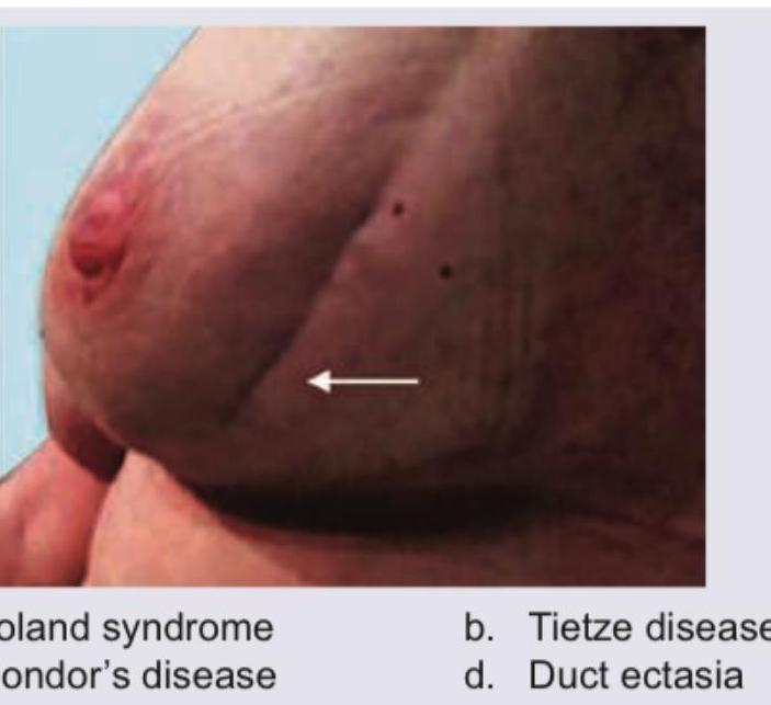 Image for question 272