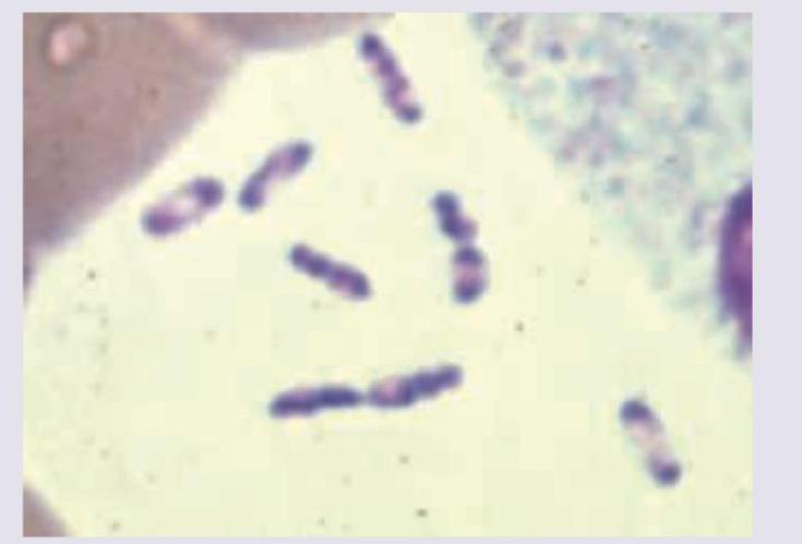 Image for question 17