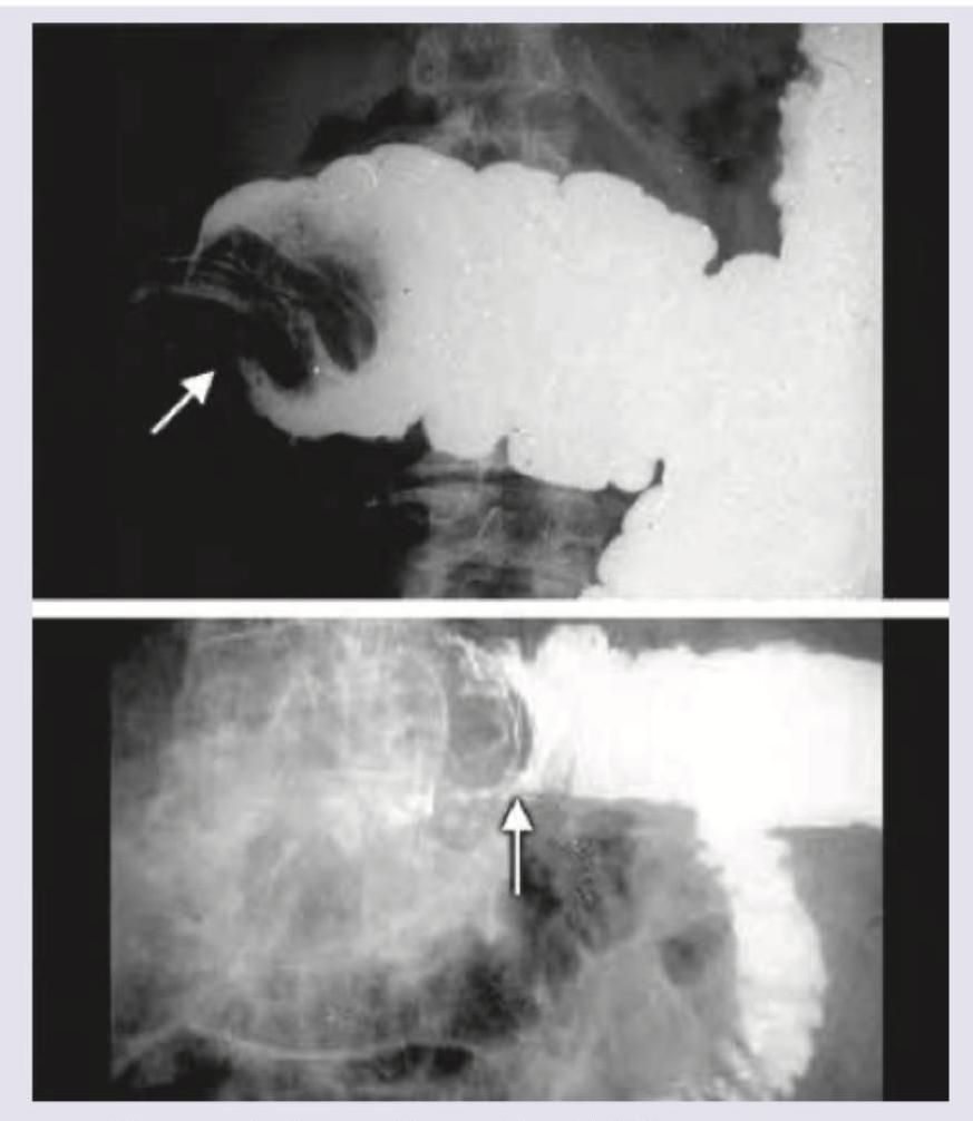 Image for question 251