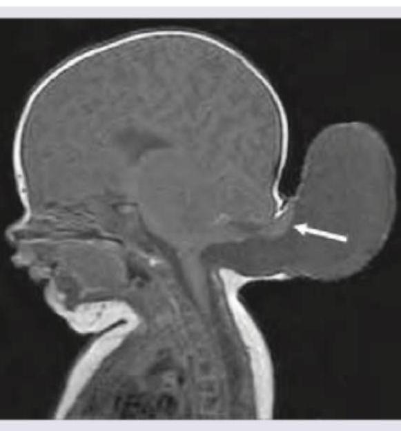 Image for question 340