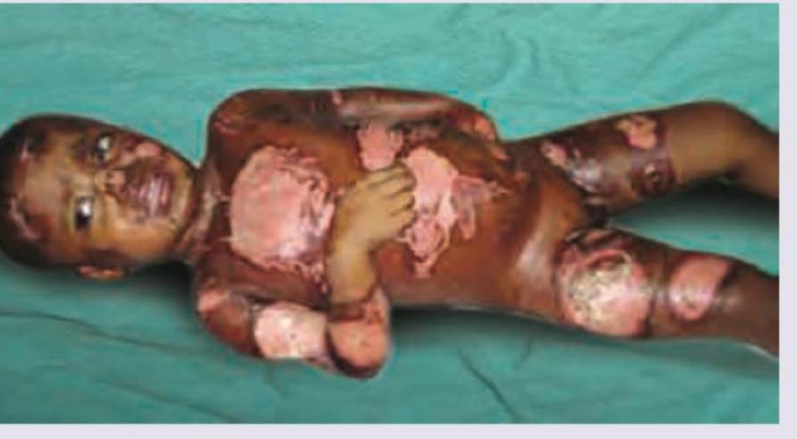 Image for question 165