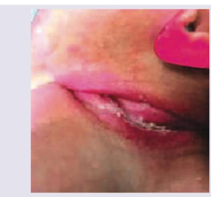 Image for question 281