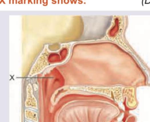Image for question 1168