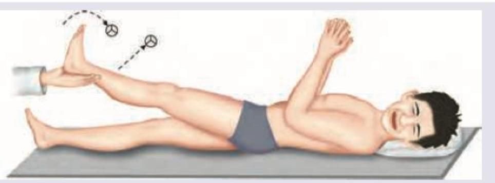 Image for question 147