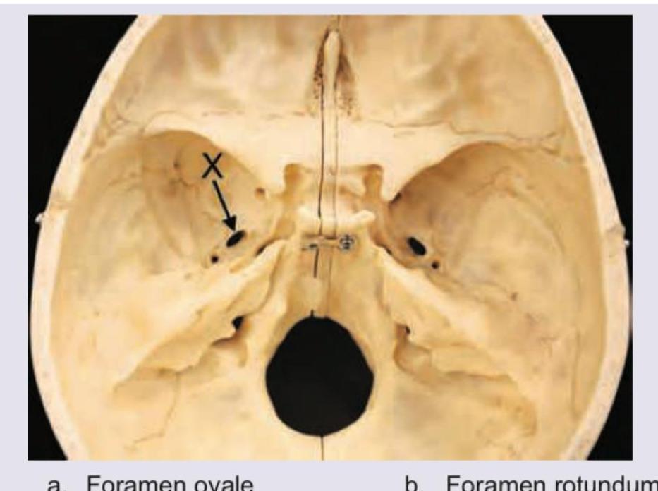 Image for question 104