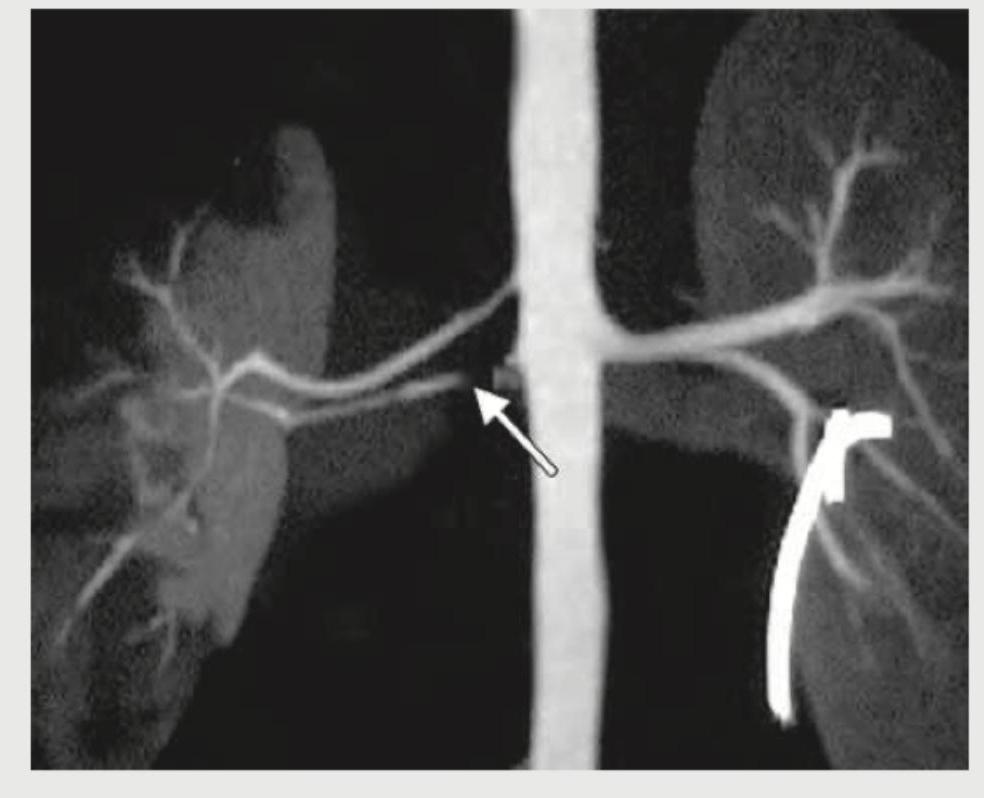 Image for question 99