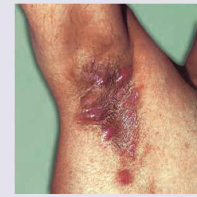 Image for question 59