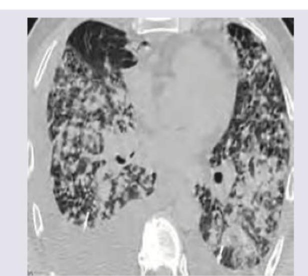 Image for question 367