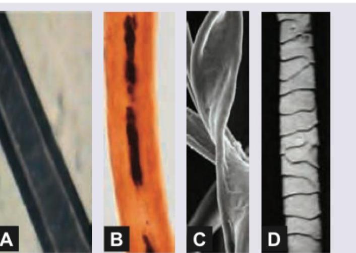 Image for question 305