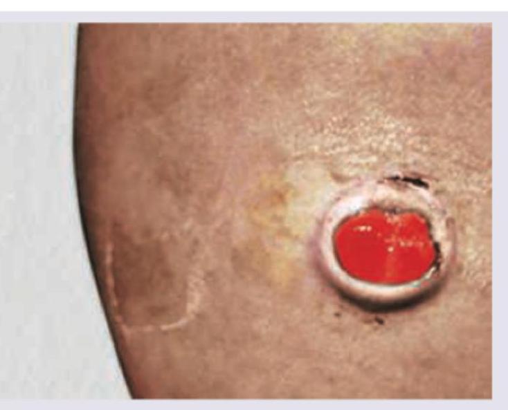 Image for question 125