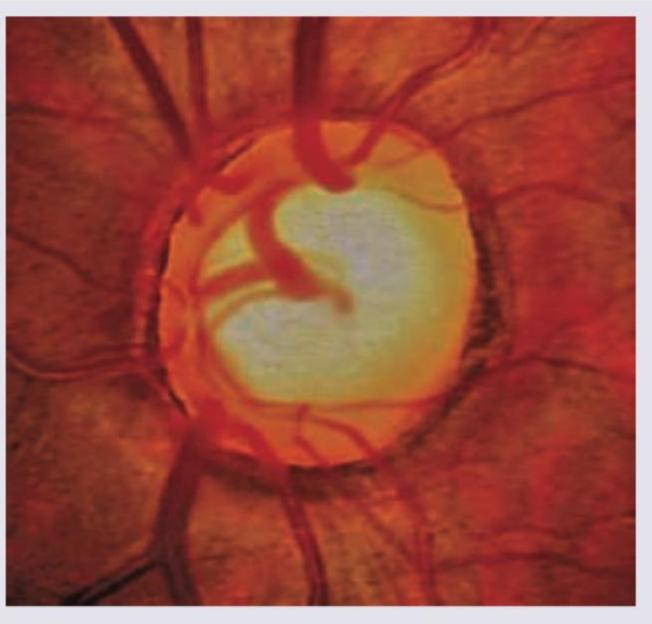 Image for question 327