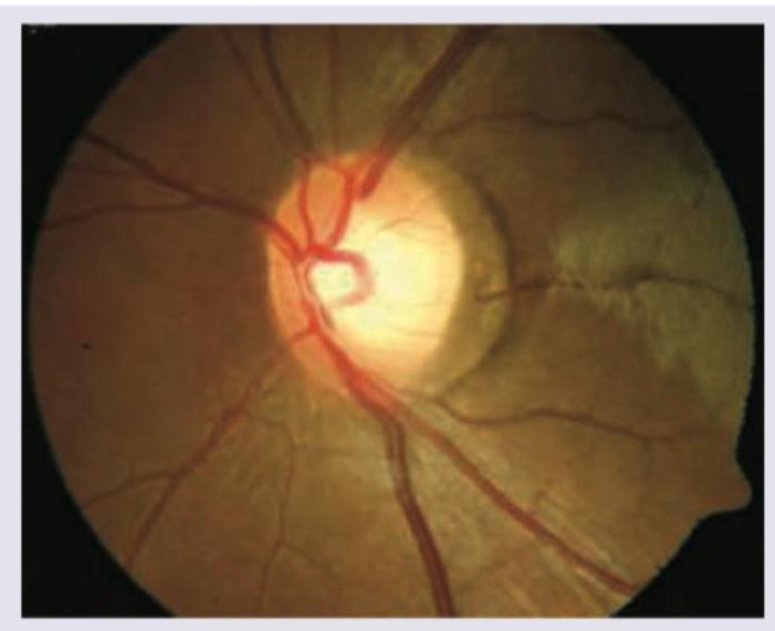 Image for question 250