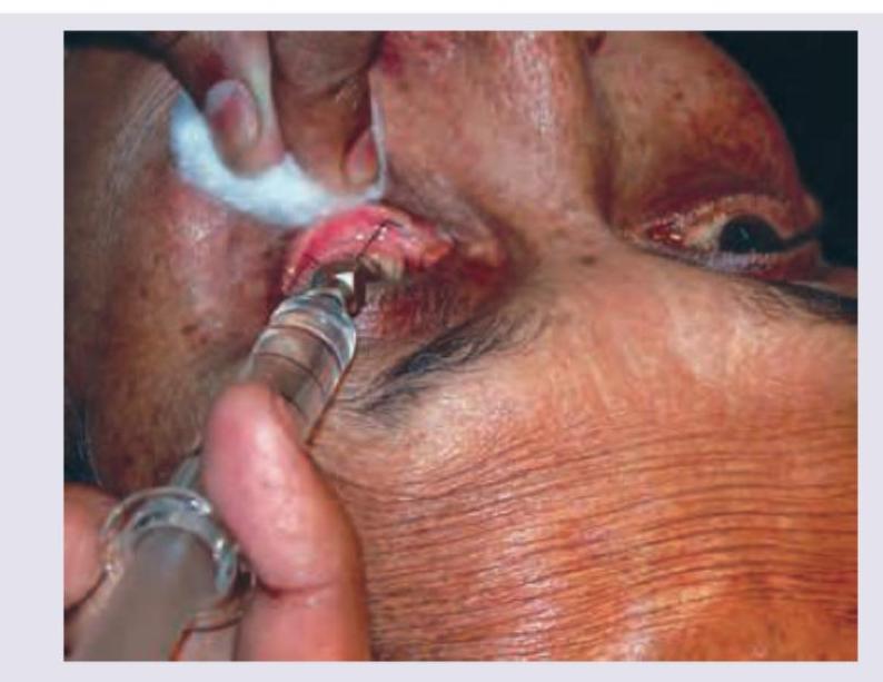 Image for question 33