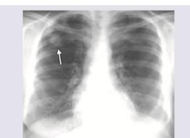 Image for question 619