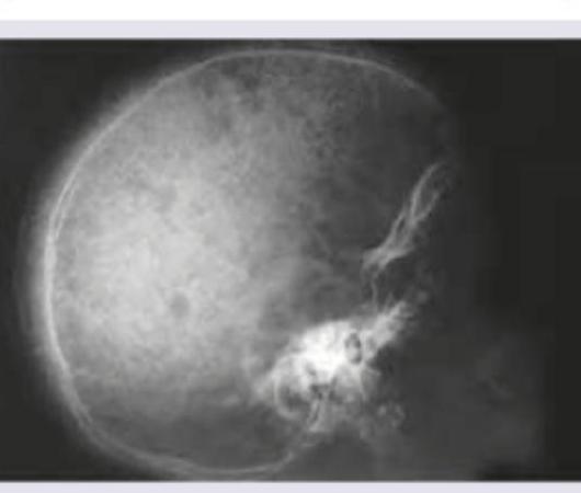 Image for question 131