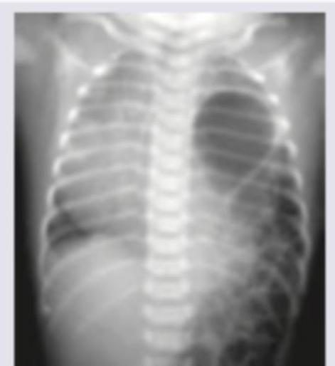 Image for question 120