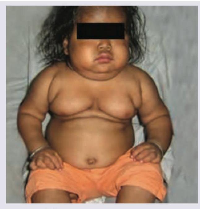 Image for question 252