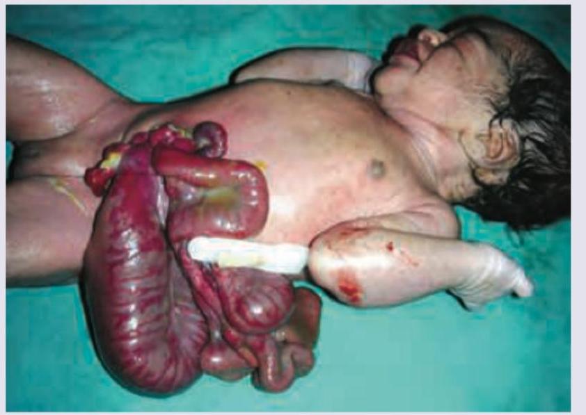 Image for question 122