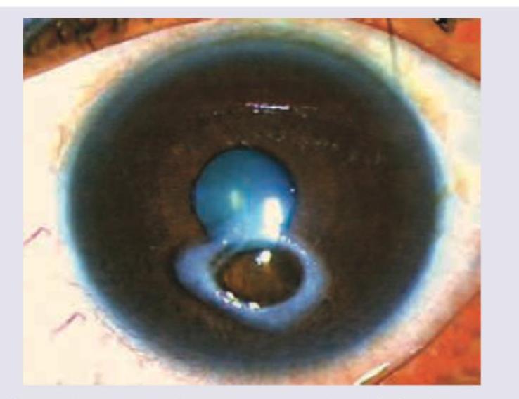 Image for question 335