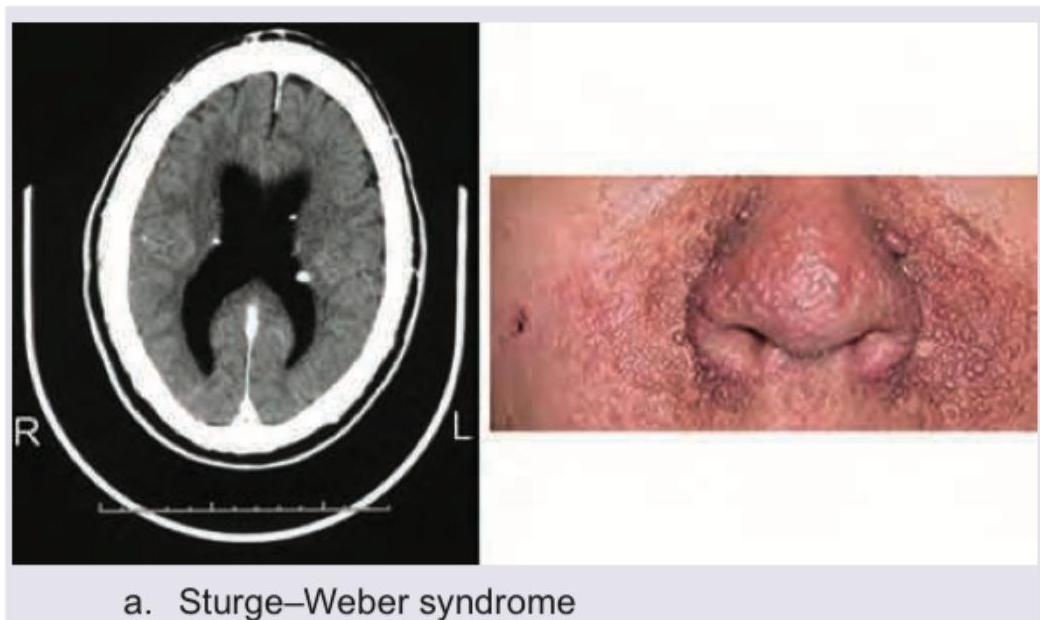 Image for question 43