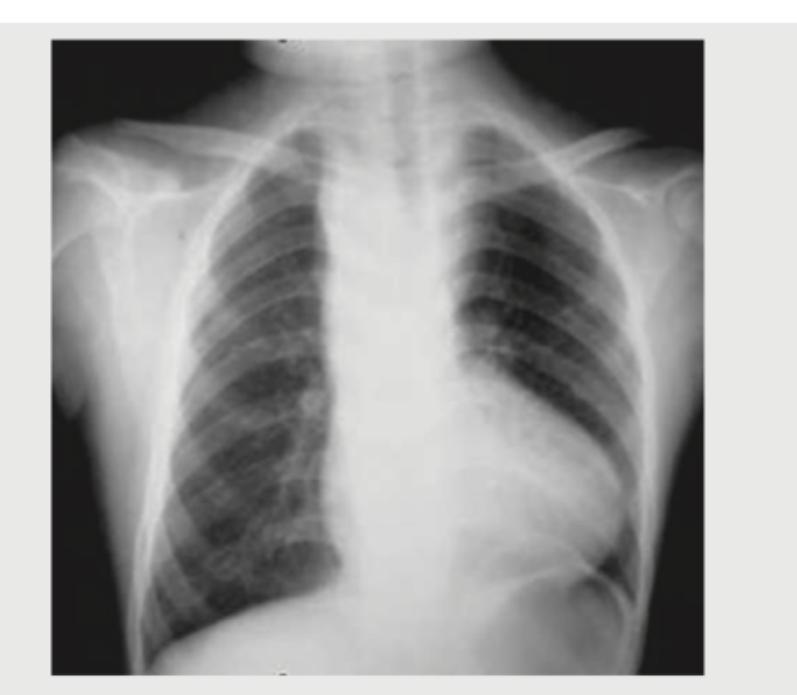 Image for question 104