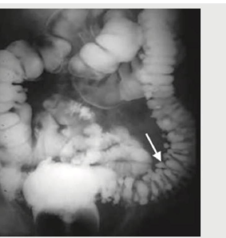 Image for question 6