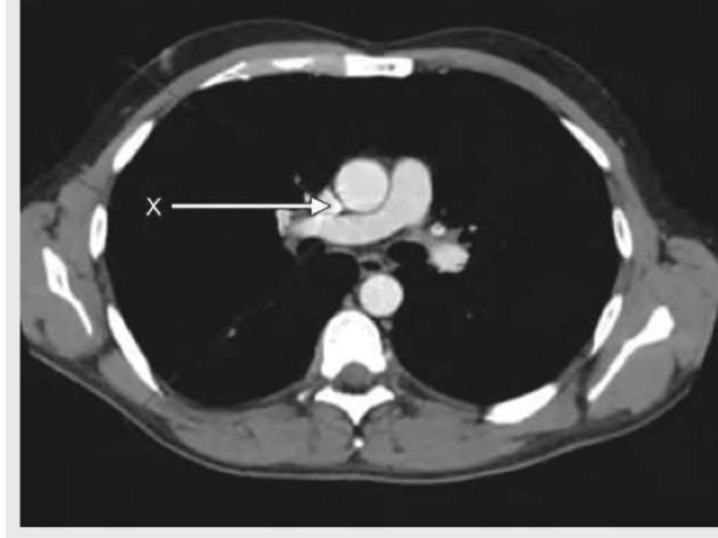 Image for question 144