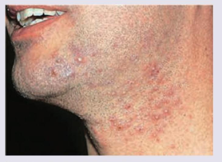 Image for question 9