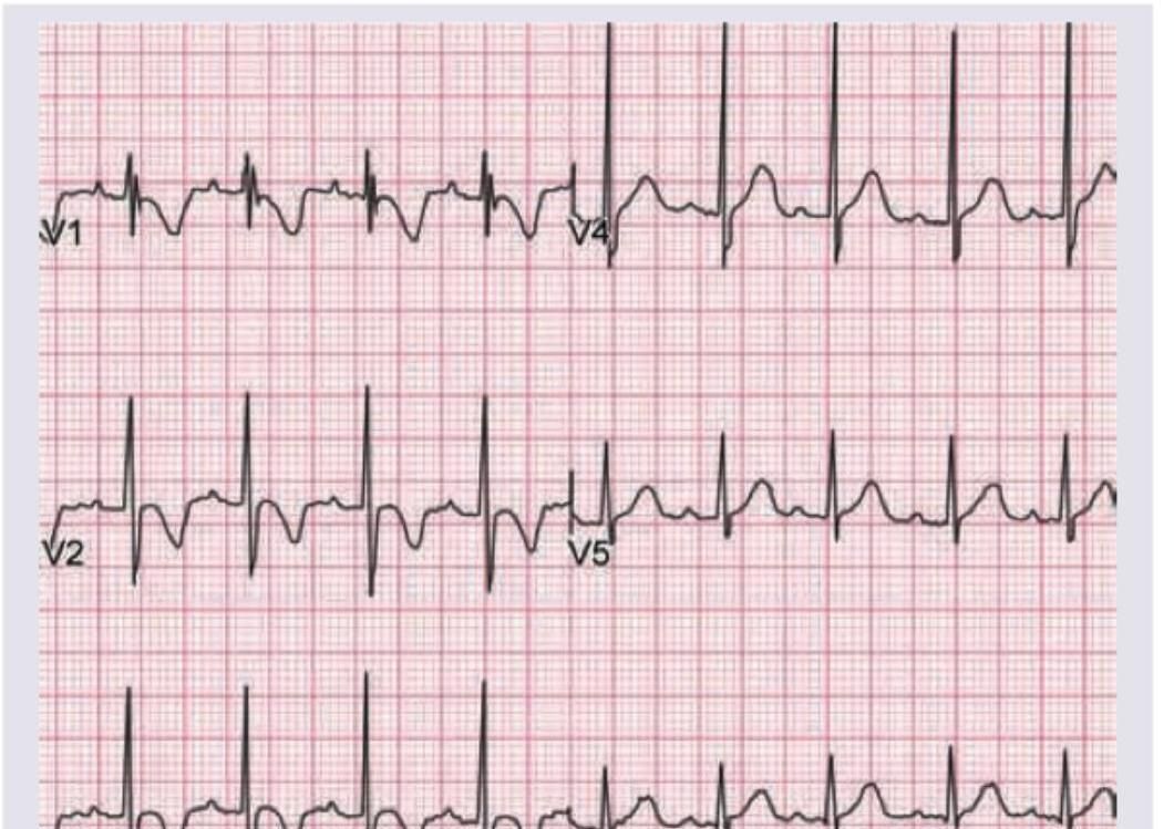 Image for question 1