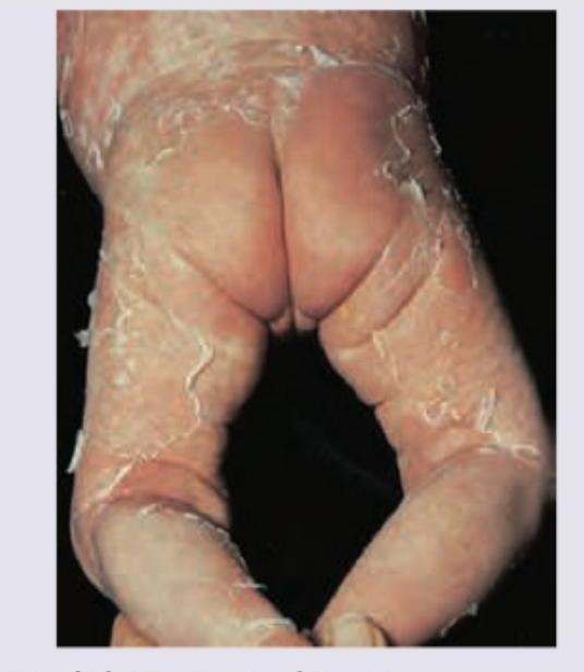 Image for question 161