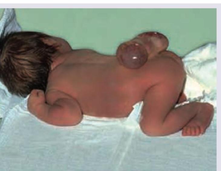 Image for question 742