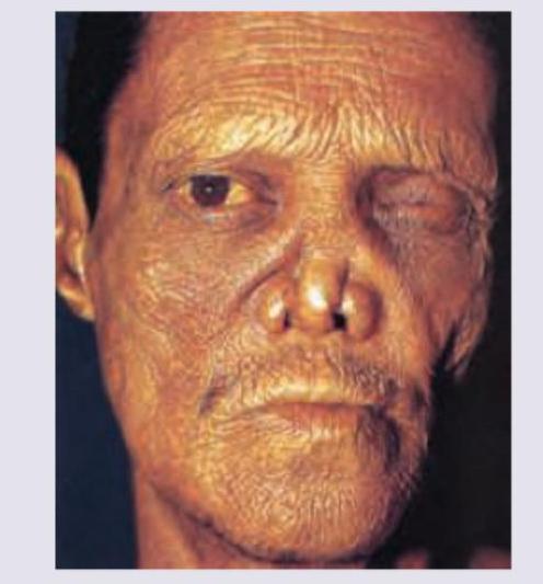 Image for question 164