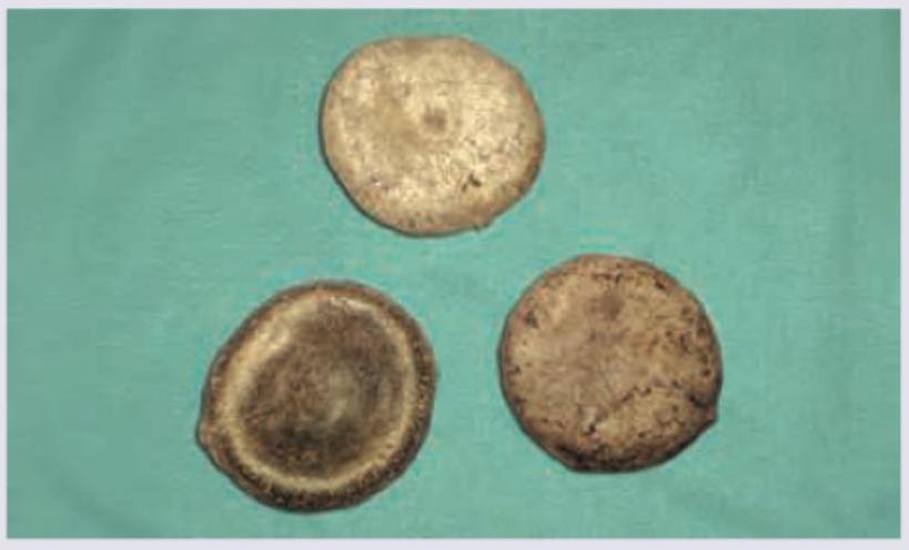 Image for question 778