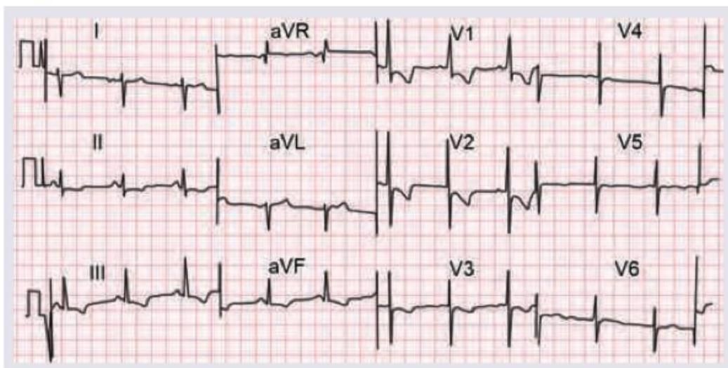 Image for question 180