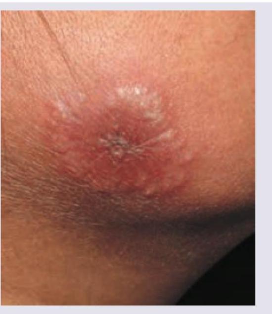 Image for question 85