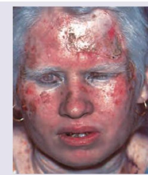 Image for question 84