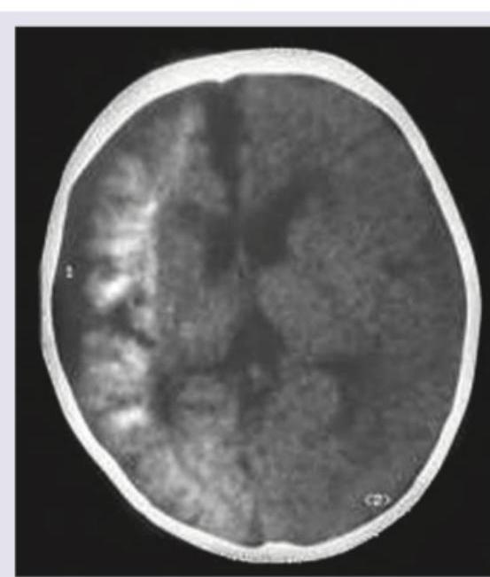 Image for question 201