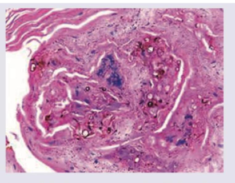 Image for question 125