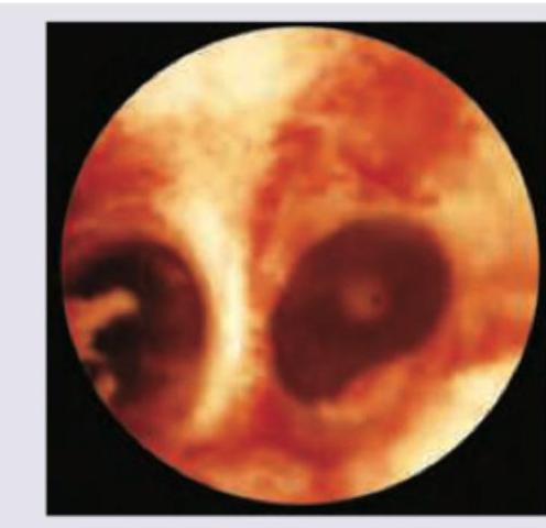 Image for question 903