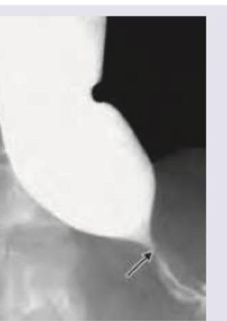Image for question 206