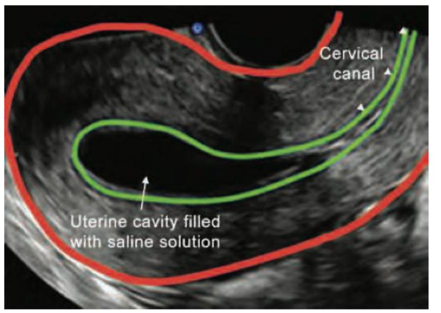 Image for question 896